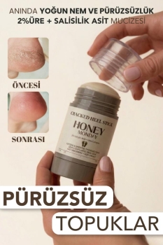 HONEY MONDAY - Ayak ve Topuk Çatlak Bakımı | Ayak Kokusu , Sertleşmiş Pürüzlü Topuklar için Kompleks Formül 35 gr